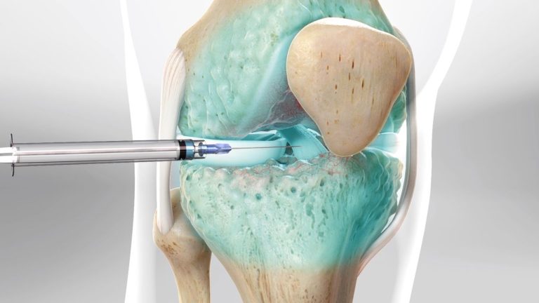 Pain Management Fundamentals